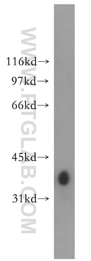 [12836-1-AP-150UL] GYG1 Polyclonal antibody