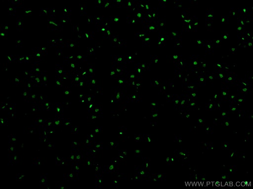 [12838-1-AP-150UL] SMARCD3 Polyclonal antibody