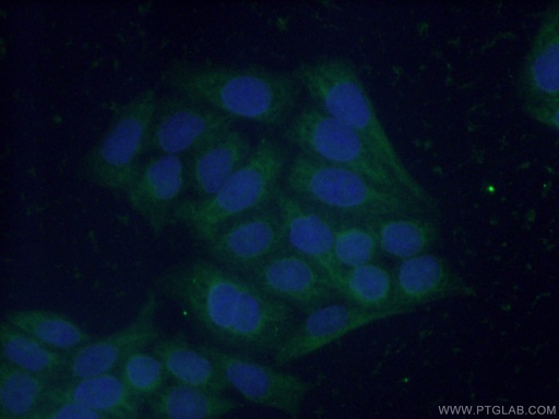 [12842-1-AP-20UL] FBP1 Polyclonal antibody