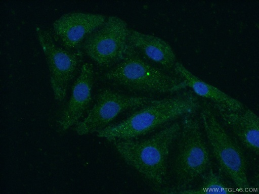 [12843-1-AP-150UL] NEK3 Polyclonal antibody