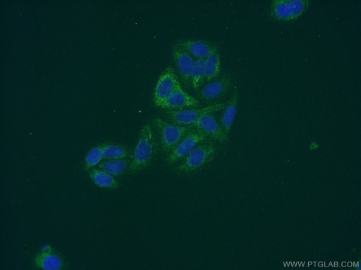 [12844-1-AP-150UL] FBXO17 Polyclonal antibody