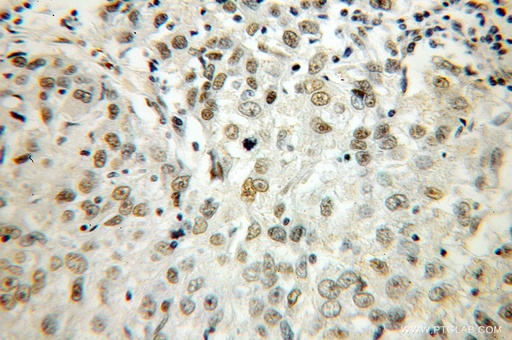 [12845-1-AP-150UL] HS1BP3 Polyclonal antibody