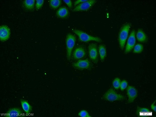 [12847-1-AP-150UL] ZMPSTE24 Polyclonal antibody