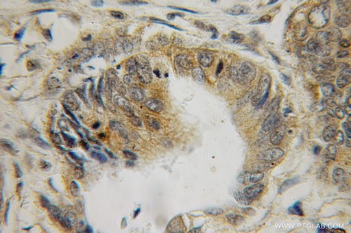[12849-2-AP-150UL] Galectin 2 Polyclonal antibody