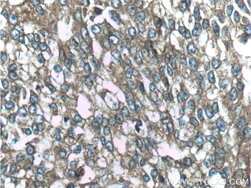 [12852-1-AP-20UL] CTPS2 Polyclonal antibody