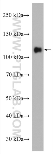 [12853-1-AP-150UL] PCDHA6 Polyclonal antibody