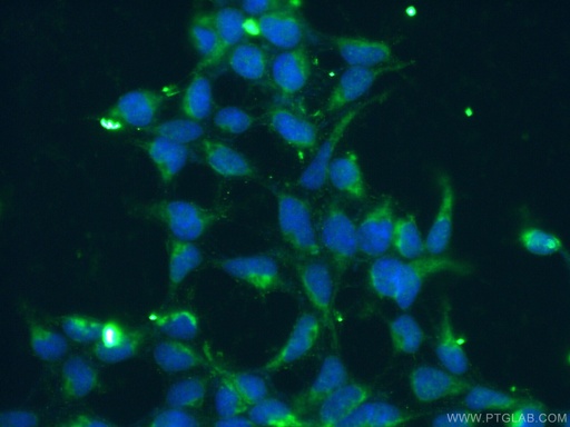 [12855-1-AP-20UL] KGA/GAC Polyclonal antibody