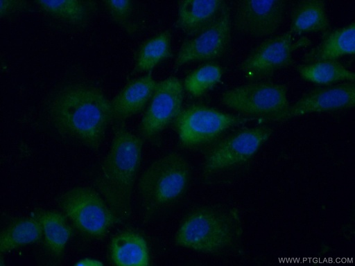 [12857-1-AP-150UL] STK33 Polyclonal antibody