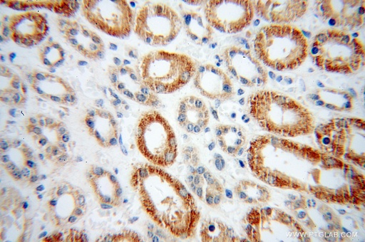 [12858-1-AP-20UL] PHYH Polyclonal antibody