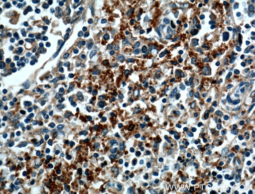[12860-1-AP-20UL] CD42b Polyclonal antibody