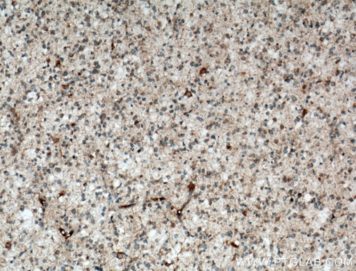 [12862-1-AP-150UL] STOML1 Polyclonal antibody