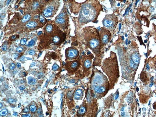 [12863-1-AP-20UL] HABP2 Polyclonal antibody