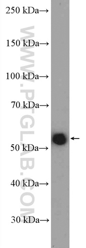 [12868-1-AP-150UL] TRAF5 Polyclonal antibody