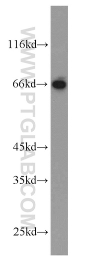 [12870-1-AP-150UL] HLF Polyclonal antibody