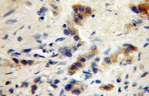 [12871-1-AP-150UL] GABRG1 Polyclonal antibody