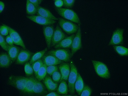 [12872-1-AP-20UL] ALG1 Polyclonal antibody