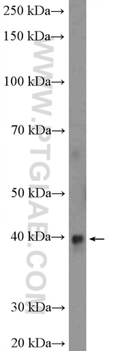 [12874-1-AP-150UL] RPP38 Polyclonal antibody