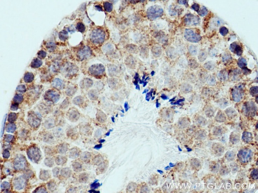 [12875-1-AP-150UL] PPEF1 Polyclonal antibody