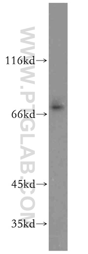 [12876-1-AP-150UL] EAAT4 Polyclonal antibody