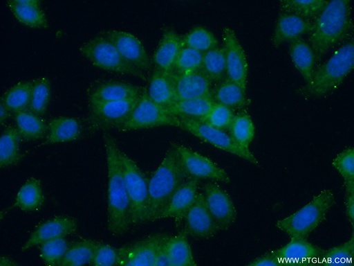 [12880-1-AP-20UL] GJB3 Polyclonal antibody