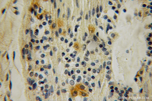 [12882-1-AP-150UL] SH2D3C Polyclonal antibody