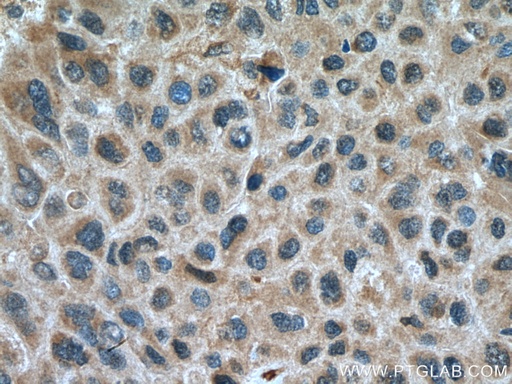 [12885-1-AP-20UL] GSDMB Polyclonal antibody