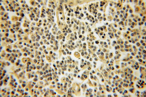 [12890-2-AP-150UL] DYRK4 Polyclonal antibody