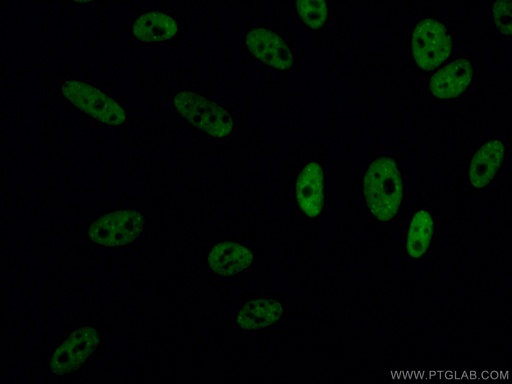 [12892-1-AP-20UL] TDP-43 (C-terminal) Polyclonal antibody