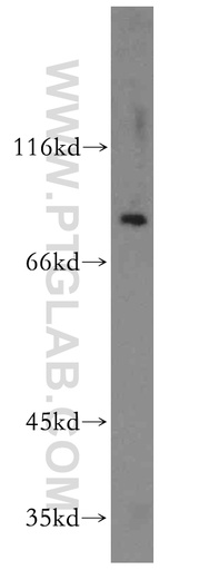 [12893-1-AP-20UL] ST5 Polyclonal antibody