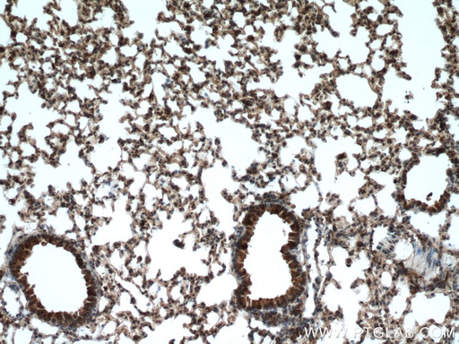 [12894-1-AP-150UL] RPN1 Polyclonal antibody