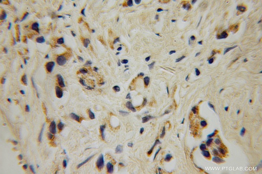 [12897-1-AP-150UL] GALNT4 Polyclonal antibody