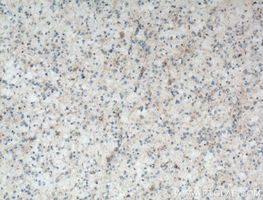 [12900-1-AP-150UL] RCAN2 Polyclonal antibody
