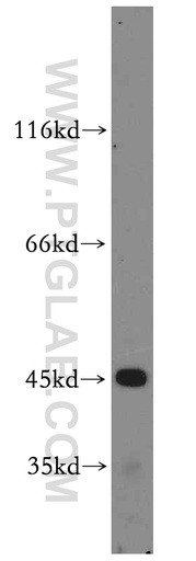 [12904-1-AP-20UL] CYP2W1 Polyclonal antibody