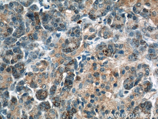 [12909-1-AP-20UL] THADA Polyclonal antibody