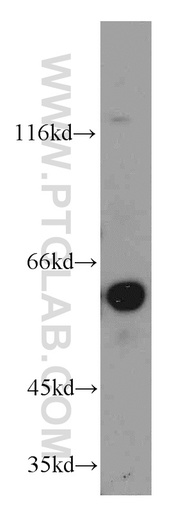 [12910-2-AP-20UL] Netrin G1 Polyclonal antibody