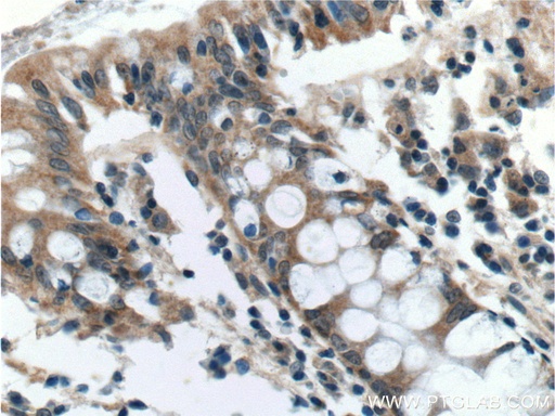 [12911-1-AP-20UL] AOAH Polyclonal antibody
