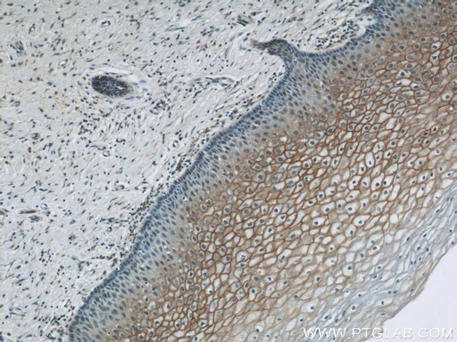 [12912-3-AP-20UL] TGM1 Polyclonal antibody