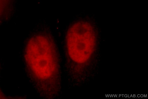 [12916-1-AP-20UL] CUL4B Polyclonal antibody