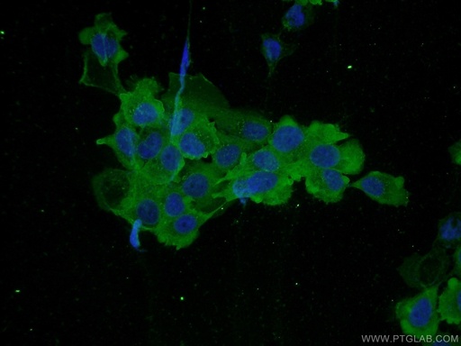 [12917-1-AP-20UL] PLS3 Polyclonal antibody