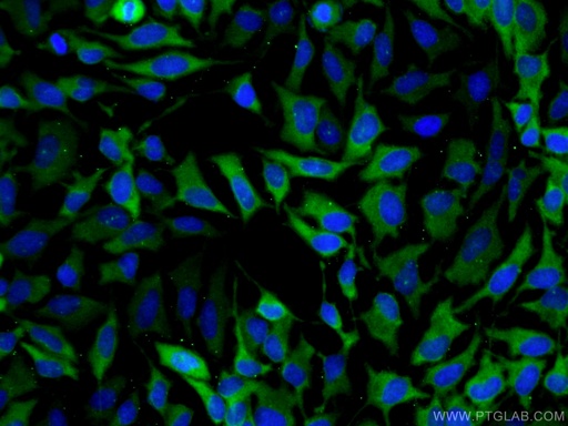 [12918-1-AP-20UL] PDE4D Polyclonal antibody
