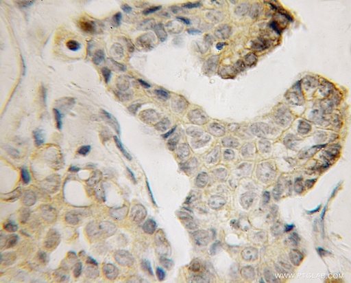 [12920-1-AP-20UL] BVES Polyclonal antibody