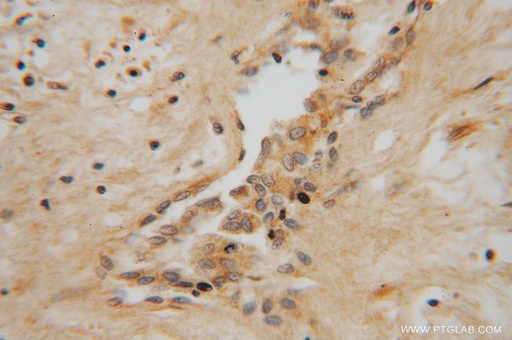 [12923-1-AP-20UL] NME5 Polyclonal antibody
