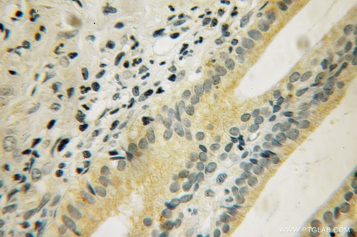 [12924-1-AP-150UL] DUSP19 Polyclonal antibody