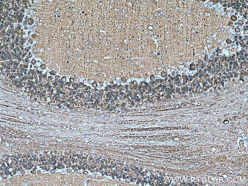 [12925-1-AP-150UL] NCALD Polyclonal antibody