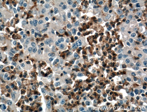 [12926-1-AP-20UL] SKAP2 Polyclonal antibody