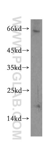 [12927-1-AP-150UL] TXNL4B Polyclonal antibody
