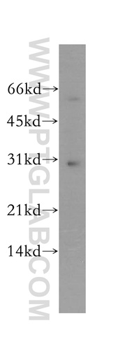 [12931-1-AP-150UL] YIPF5 Polyclonal antibody