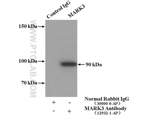 [12932-1-AP-20UL] MARK3 Polyclonal antibody