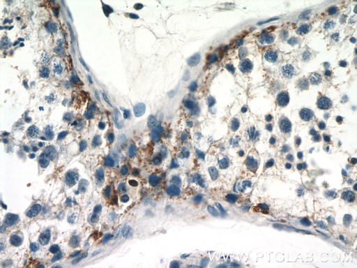 [12935-1-AP-150UL] RASGAP Polyclonal antibody