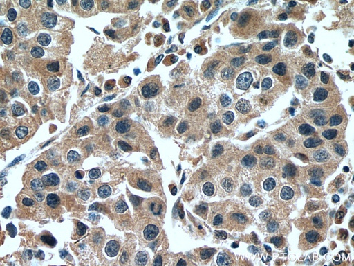 [12936-1-AP-150UL] NFE2L1 Polyclonal antibody
